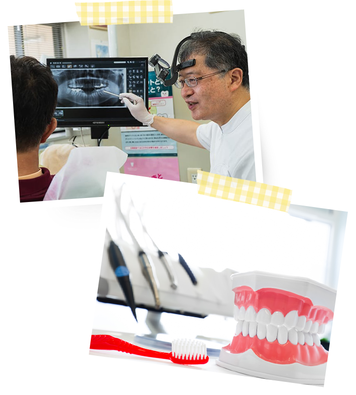 予防歯科ってなぜ必要なの？