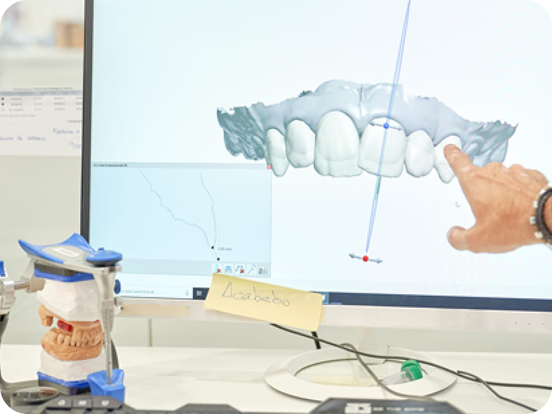 つめ物・かぶせ物